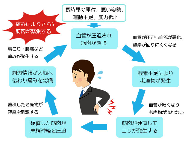 長時間の座位、悪い姿勢などから筋肉が緊張し、痛みの悪循環が発生。