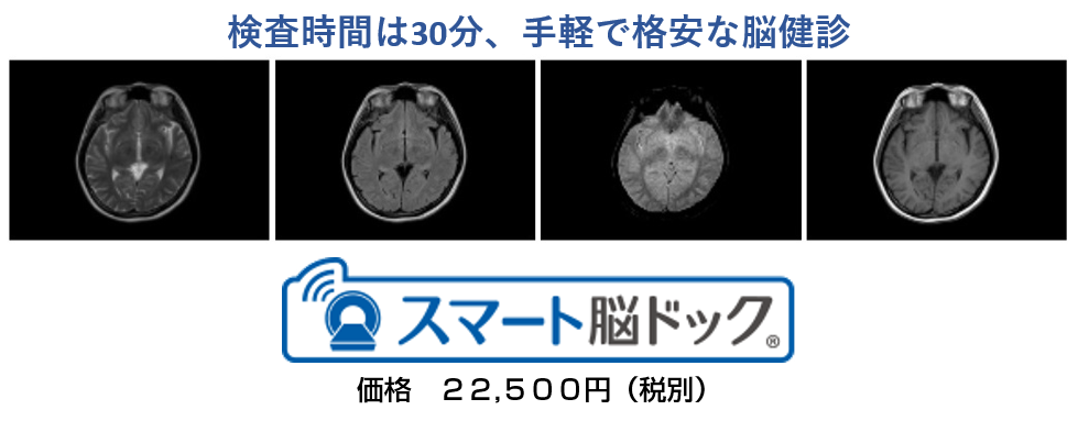 スマート脳ドック